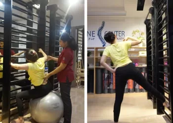 Deteksi dini jadi kunci keberhasilan penanganan skoliosis