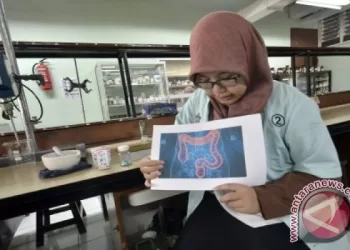 Tanda tubuh butuh asupan probiotik
