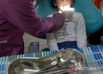 Dokter anjurkan tambal gigi meski lubang kecil