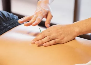 Dokter jelaskan jenis akupunktur, kovensional hingga tanam benang