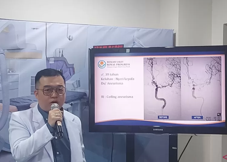 Dokter bisa tekan ‘emboli kolesterol’ lewat radiologi intervensi