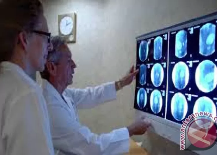 Dokter: Anjuran jalan kaki dan naik tangga baik bagi kesehatan