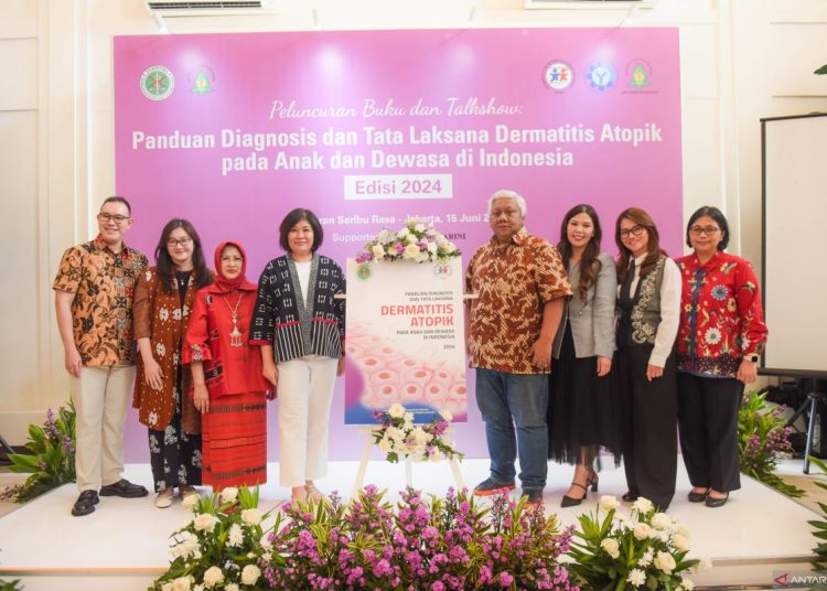 KSDAI bersama Menarini luncurkan panduan diagnosis dermatitis atopik