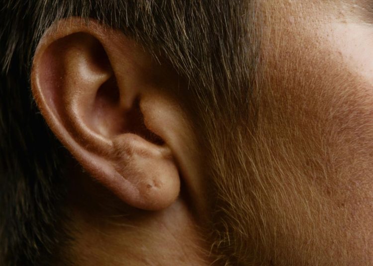Waspada pertumbuhan rambut tak biasa tanda kondisi kulit langka