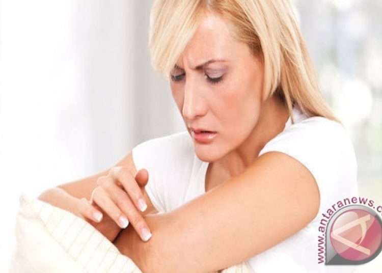 Ini gejala seseorang terkena kurap menurut dokter kulit RSCM