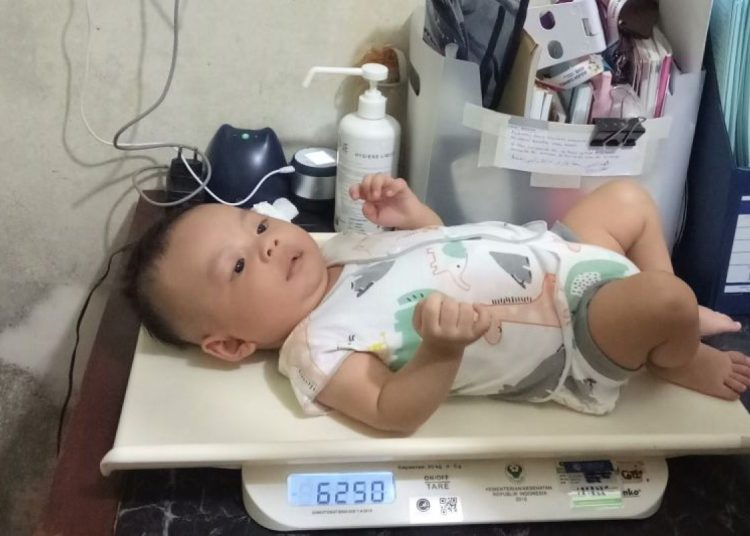 Anak perlu segera diperiksa jika terlambat perkembangan motorik