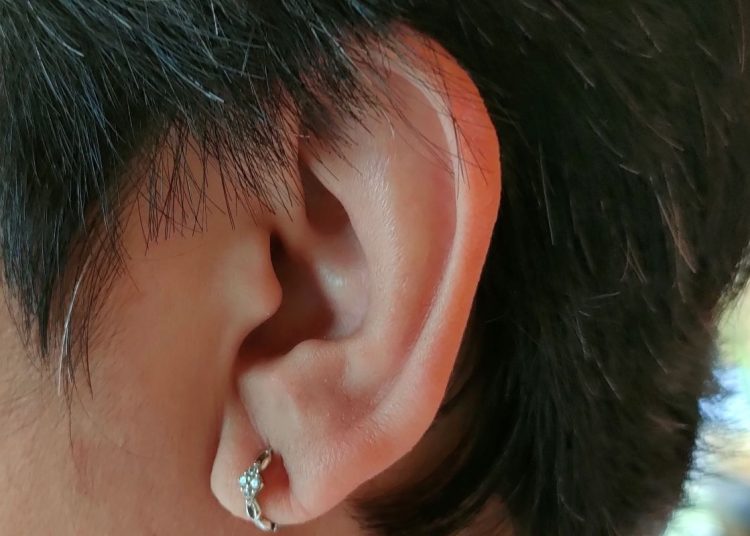 Kenali kondisi dan gejala telinga tinnitus