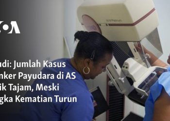 Jumlah Kasus Kanker Payudara di AS Naik Tajam, Meski Angka Kematian Turun