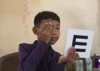 Dokter: Tangani mata malas pada anak, guna cegah kebutaan saat dewasa