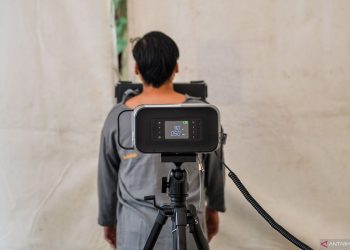 Komorbiditas dan gaya hidup bisa perparah pneumonia pada orang dewasa