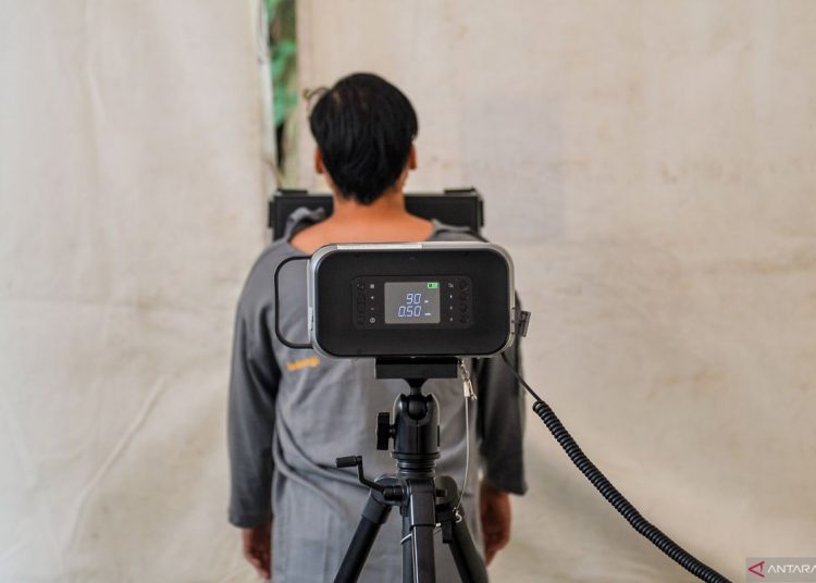 Komorbiditas dan gaya hidup bisa perparah pneumonia pada orang dewasa