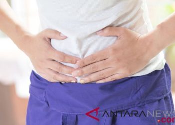 Operasi batu kantong empedu bisa cegah komplikasi lebih berat 