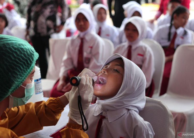 Jenis minuman yang bisa menimbulkan noda pada gigi