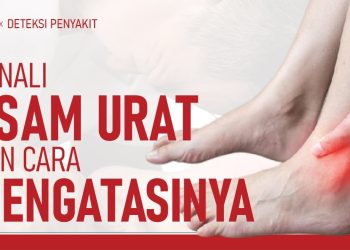 Asam Urat, Gejala Dan Cara Pencegahanya! | Hidup Sehat Tvone