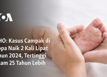 Kasus Campak di Eropa Naik 2 Kali Lipat Tahun 2024, Tertinggi dalam 25 Tahun Lebih
