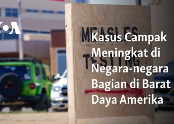 Kasus Campak Meningkat di Negara-negara Bagian di Barat Daya Amerika