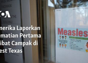 Amerika Laporkan Kematian Pertama akibat Campak di West Texas