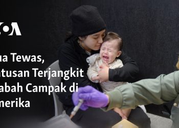 Dua Tewas, Ratusan Terjangkit Wabah Campak di Amerika